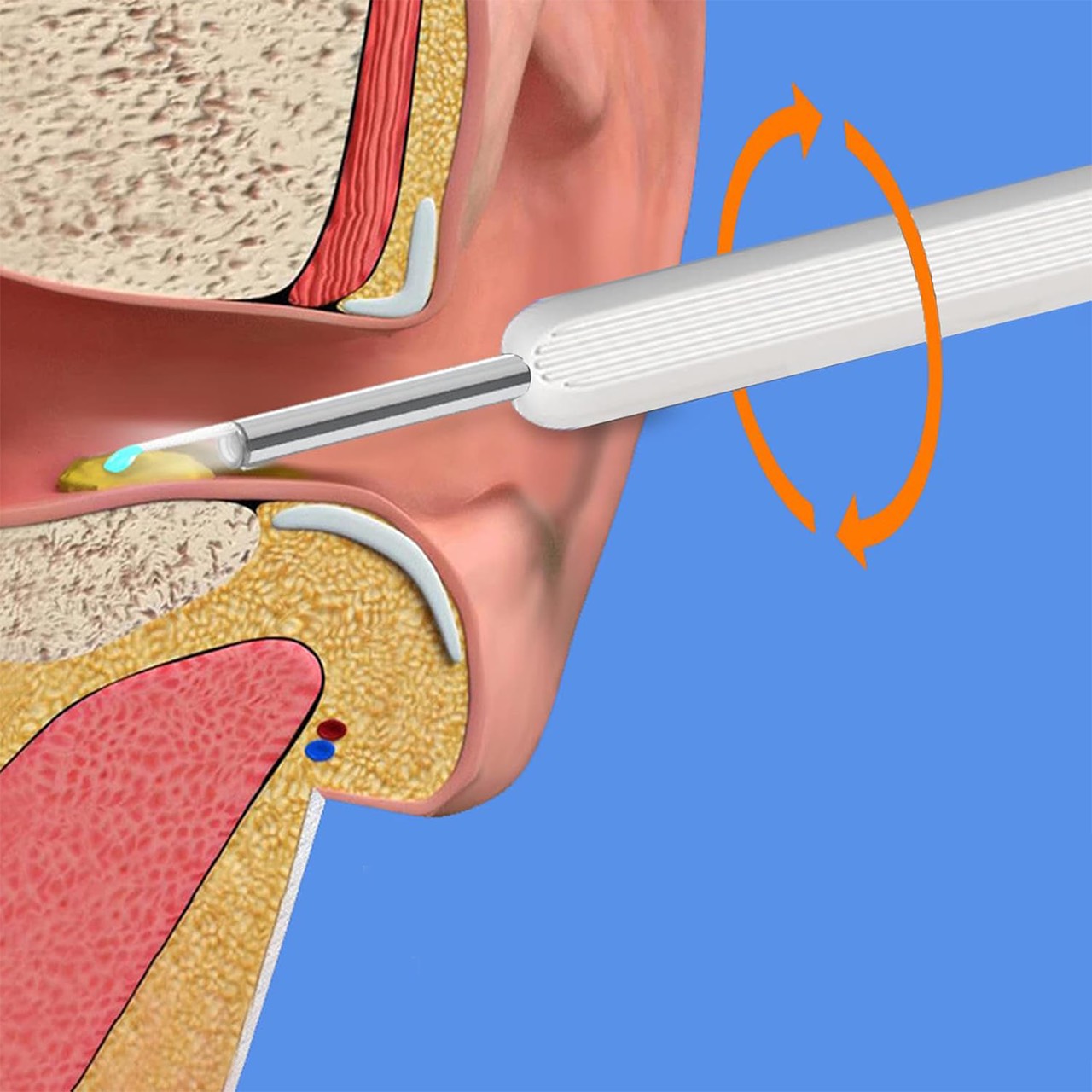 EarStick, pomoćno sredstvo za čišćenje ušnog voska s kamerom - Image 2