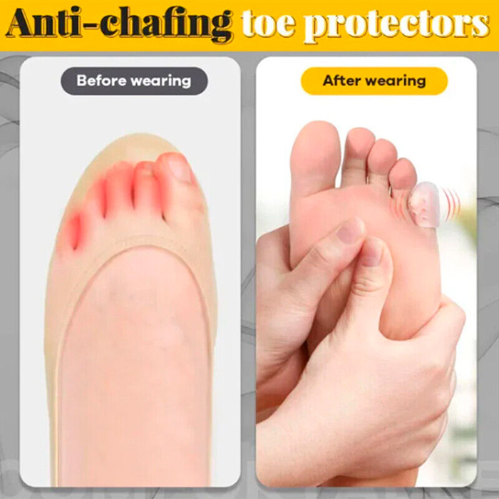 ToeProtector, silikonski štitnik za prste (10 komada) - Image 5